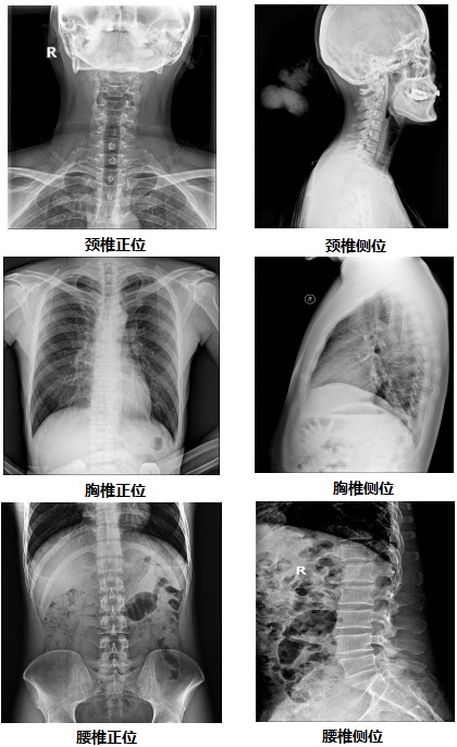 固定懸吊dr-PLD7800E部(bu)分(fēn)臨牀(chuang)效果圖