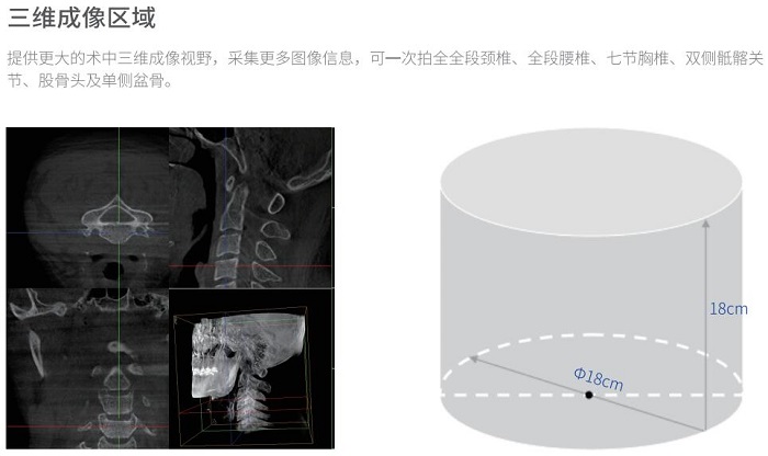 移動(dòng)三維(wei)C形臂術(shù)中(zhong)成(cheng)像